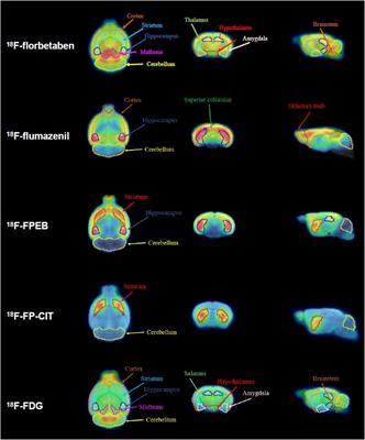 Amyloid pathology induces dysfunction of systemic neurotransmission in aged APPswe/PS2 mice